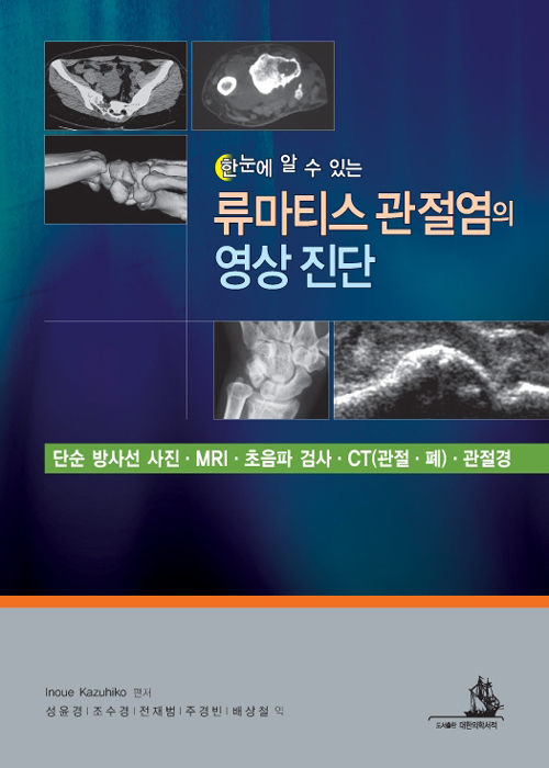 류마티스 관절염의 영상 진단-한눈에 알 수 있는