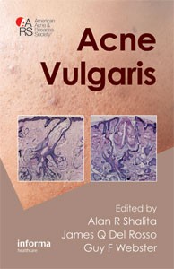 Acne Vugaris
