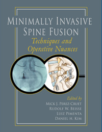 Minimally Invasive Spine Fusion: Techniques and Operative Nuances