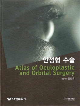 안성형 수술