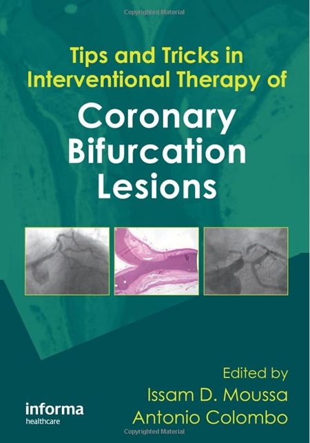 Tips and Tricks in Interventional Therapy of Coronary Bifurcation Lesions