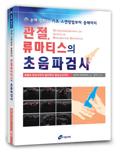 관절류마티스의 초음파검사 - 손에 잡히는 기초스캔방법부터 증례까지