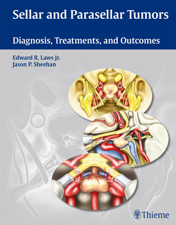 Sellar and Parasellar Tumors