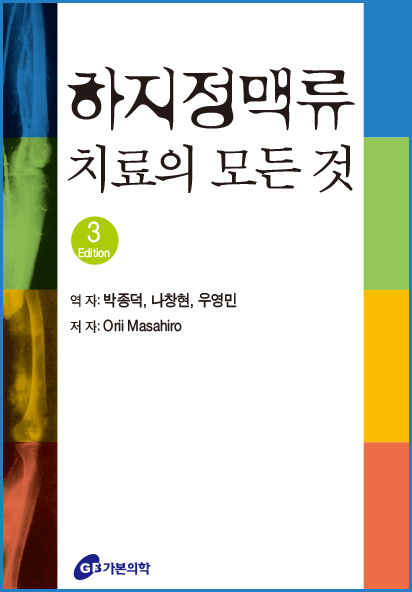 하지정맥류 치료의 모든 것
