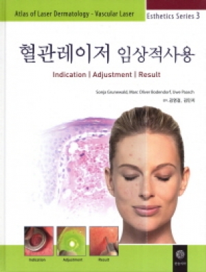 혈관레이저 임상적사용