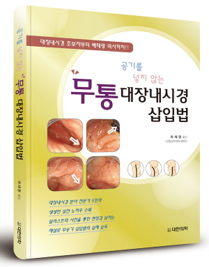 공기를 넣지 않는 무통대장내시경 삽입법