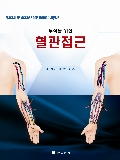 투석을 위한 혈관접근