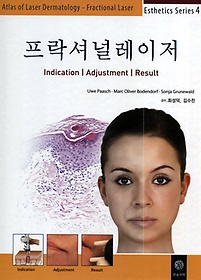 프락셔널레이저