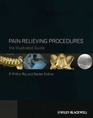 Pain-Relieving Procedures: The Illustrated Guide