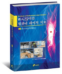 하지정맥류 혈관내 레이저치료-1판