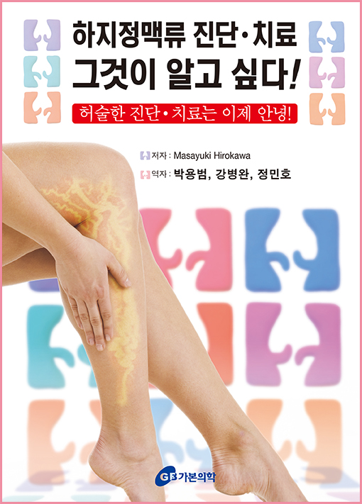 하지정맥류진단치료 그것이알고싶다!