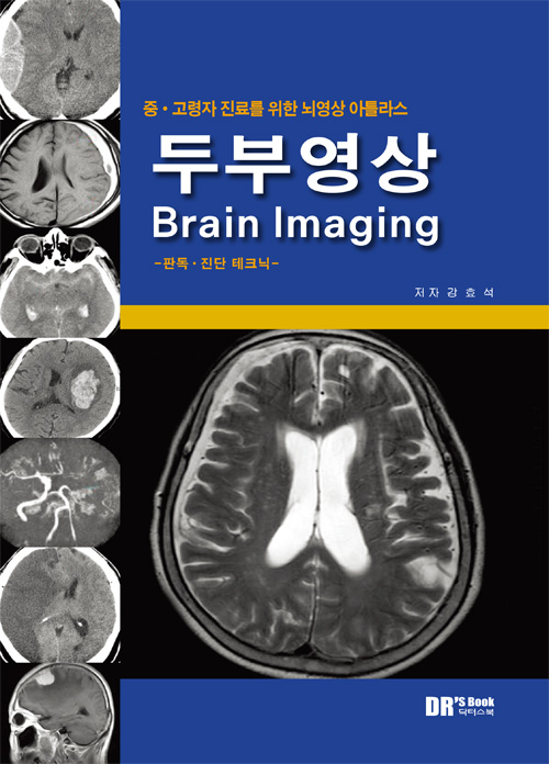 중고령자 진료를 위한 뇌영상아틀라스 두부영상