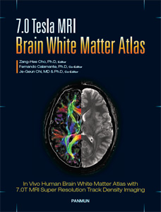 7.0 Tesla MRI Brain White Matter Atlas