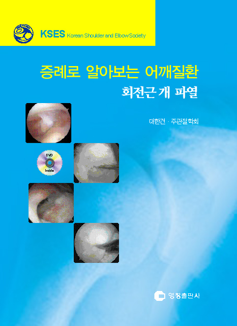증례로 알아보는 어깨질환-회전근개 파열