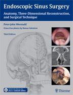 Endoscopic Sinus Surgery 3/e