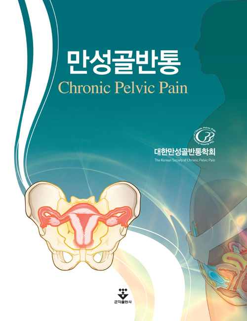 만성골반통