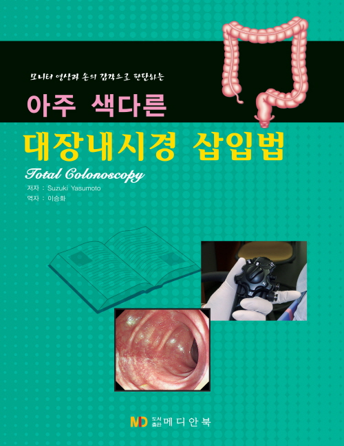 아주 색다른 대장내시경 삽입법 - 모니터영상과 손의 감각으로 판단하는 -
