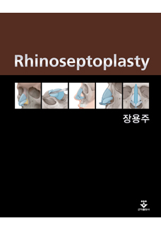 Rhinoseptoplasty