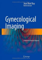 Gynecological Imaging: A Reference Guide to Diagnosis