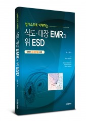 식도·대장 EMR과 위: 일러스트로 이해하는(안전한 내시경치료 요령)