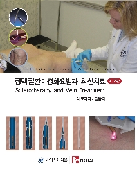 정맥질환-경화요법과 최신자료