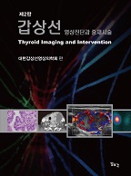 갑상선 영상진단과 중재시술 2판