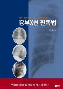 흉부X선판독법: 해부 판독요령 실전3단계로 배우는