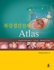 복강경간절제Atlas