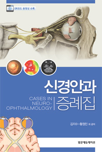 신경안과증례집