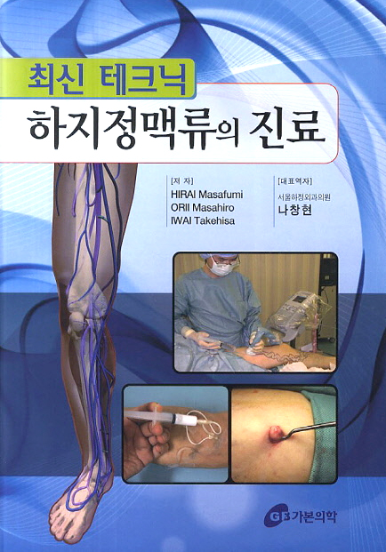 최신테크닉 하지정맥류의진료