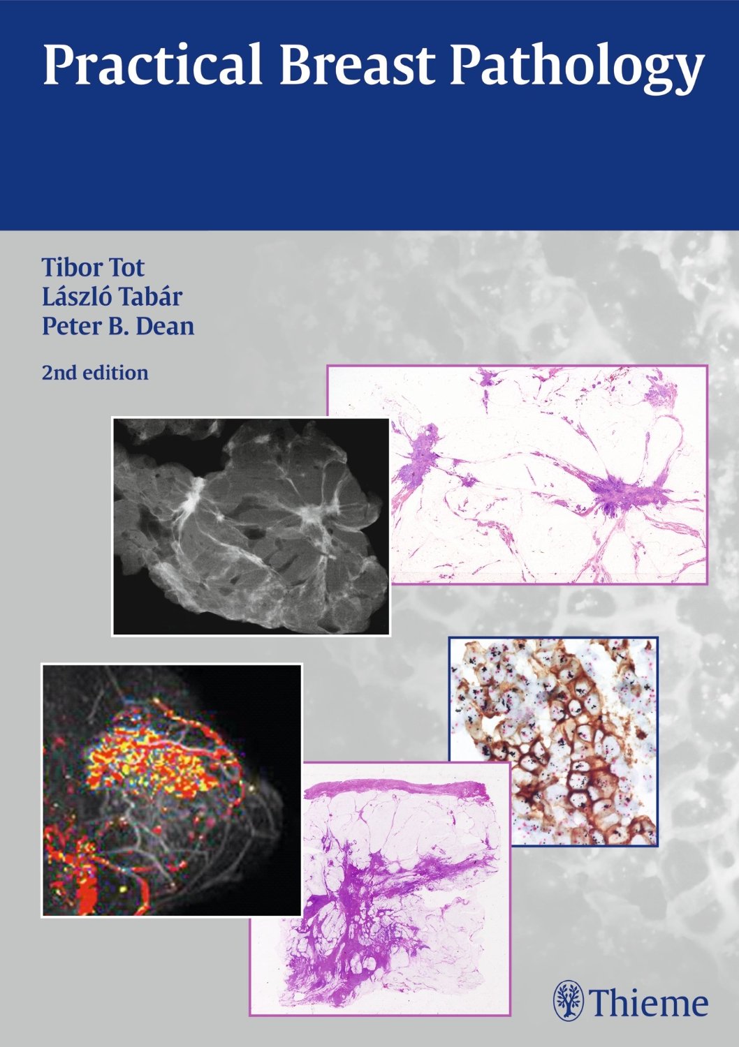 Practical Breast Pathology 2/e