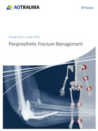 Periprosthetic Fracture Management