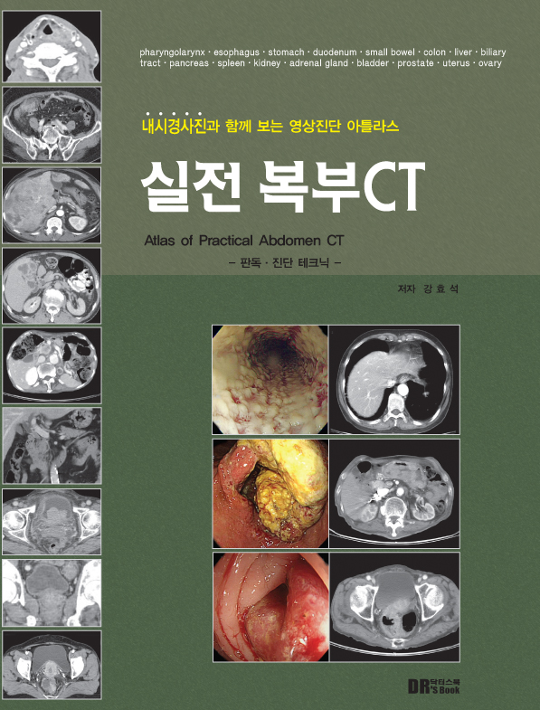 내시경사진과 함께 보는 영상진단 아틀라스 실전 복부CT