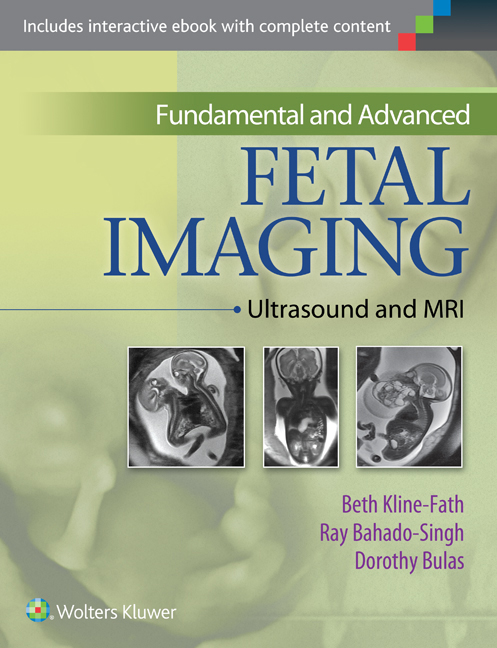 Fundamental and Advanced Fetal Imaging: Ultrasound and MRI