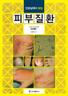 진료실에서 보는 피부질환-1판