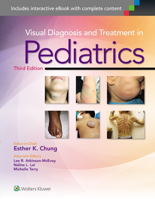 Visual Diagnosis and Treatment in Pediatrics 3e