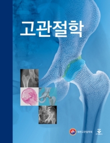 고관절학-1판