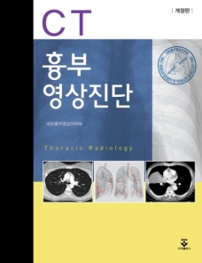 흉부영상진단CT 2판