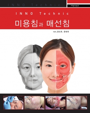 미용침과 매선침