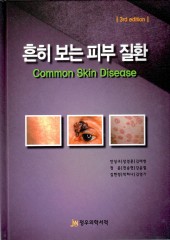 흔히보는 피부질환