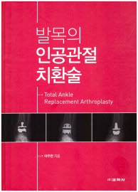 발목의 인공관절 치환술