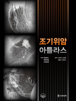 조기위암 아틀라스