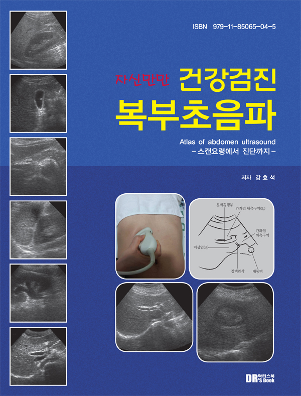 자신만만 건강검진 복부초음파
