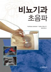 비뇨기과초음파
