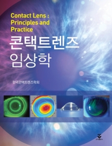 최신 콘택트렌즈 임상학