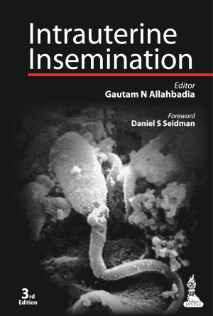 Intrauterine Insemination