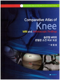 슬관절 MRI와 관절경소견 비교도감
