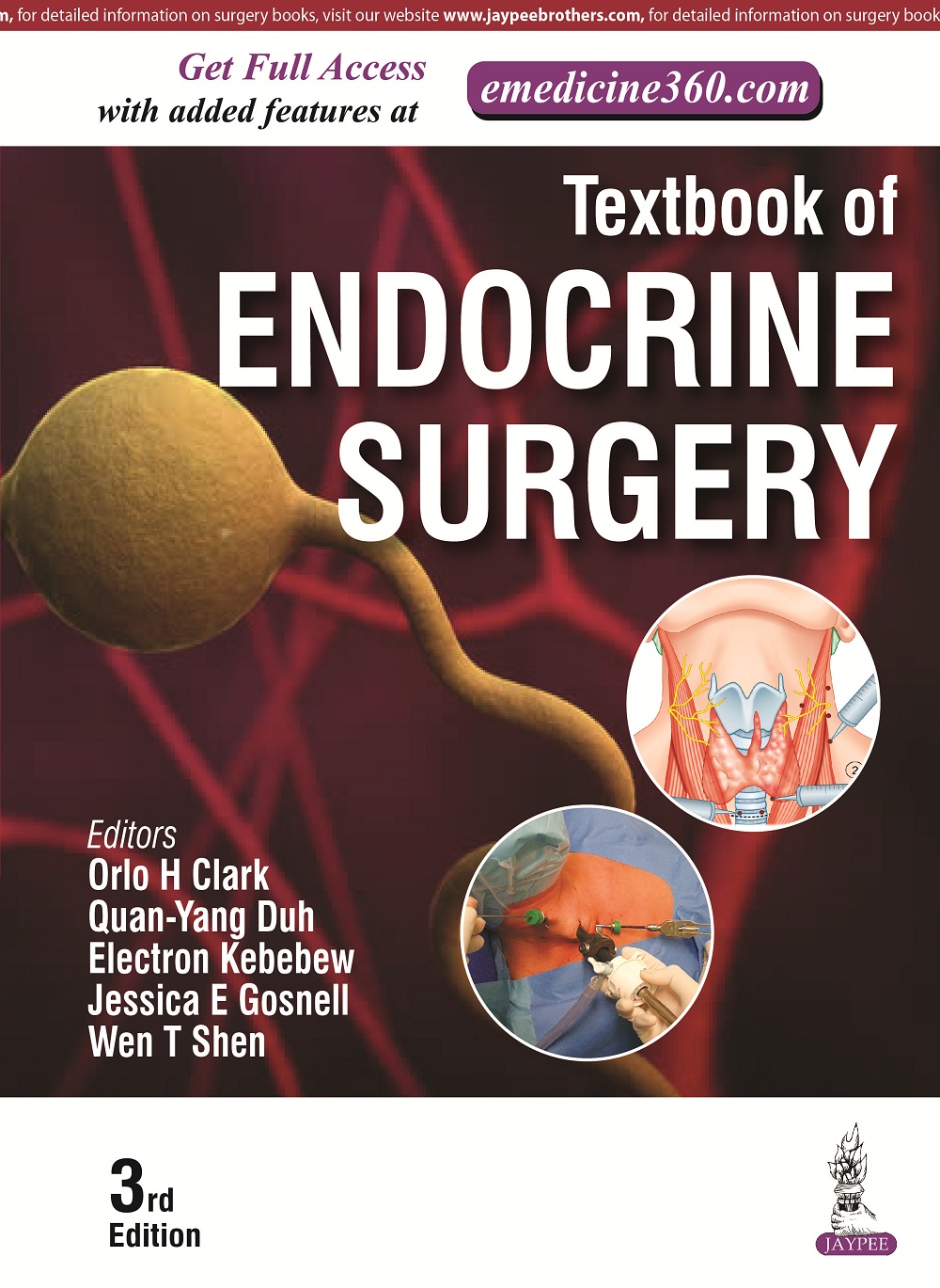 Textbook of Endocrine Surgery-3판