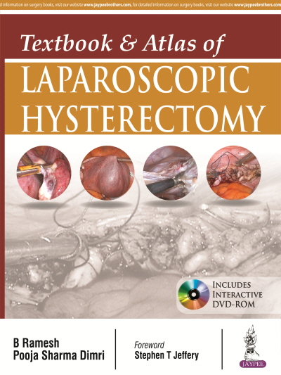Textbook and Atlas of Laparoscopic Hysterectomy