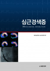 심근경색증